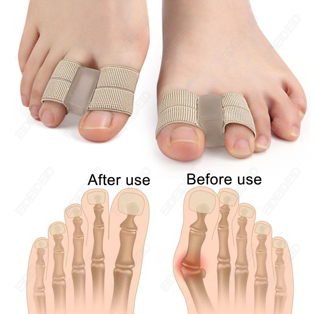 Bunion toe Corrector Orthotics - Women'S Shoes For Bunions 리뷰 및 가격